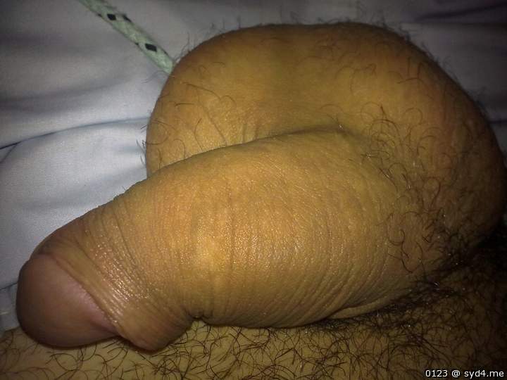 Photo of a middle leg from 0123
