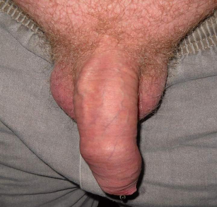 Photo of a private part from Sharkie