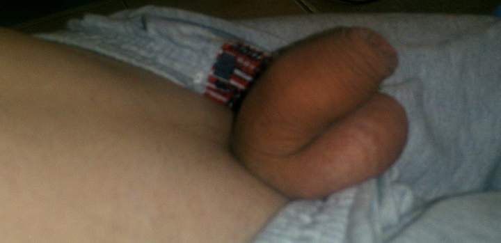 Photo of a private part from babarianboy