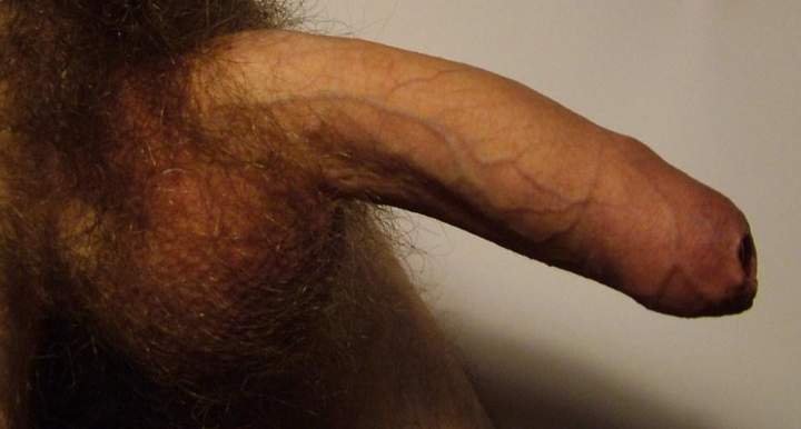 Photo of a wiener from vtbartje
