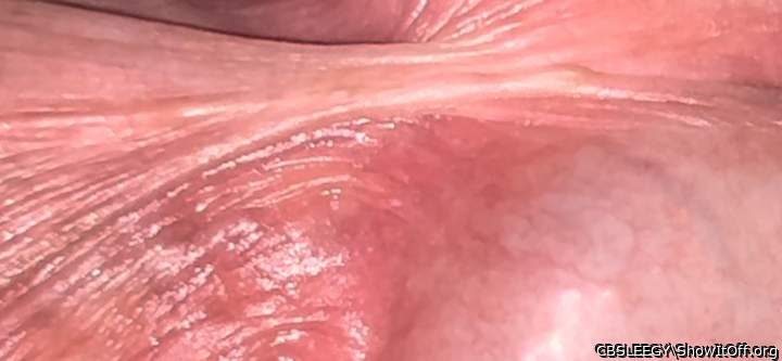Frenulum close-up from the side, showing nerves in the helmet!