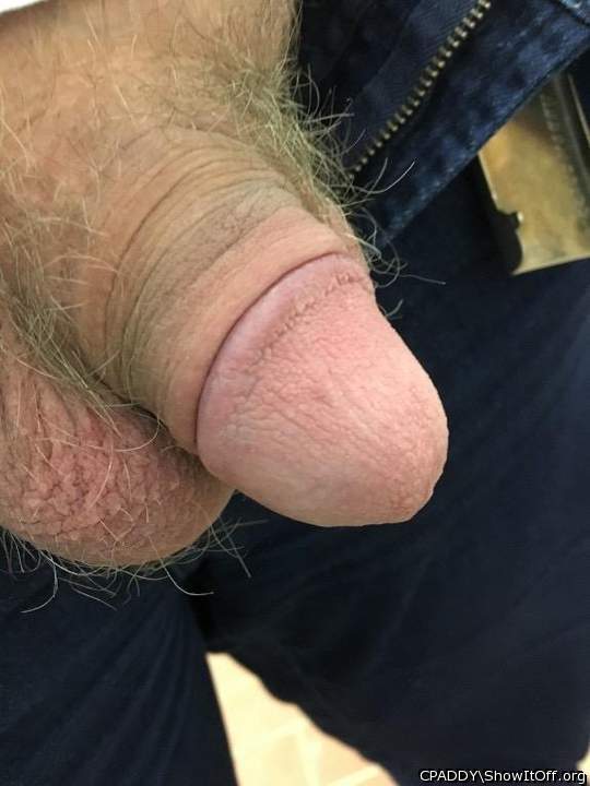 My Circumcised Dick-Do you like it?