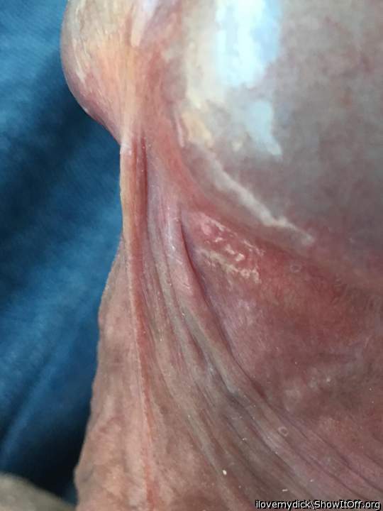 Close ups