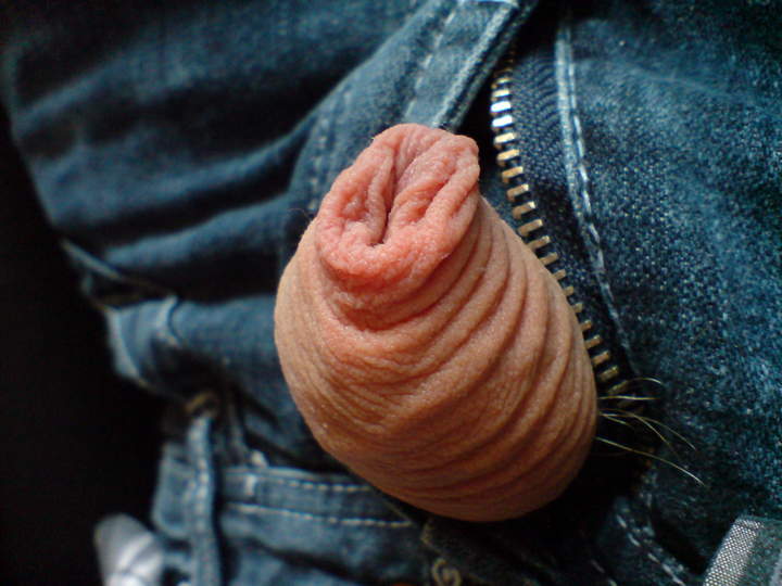 Beautiful foreskin!  