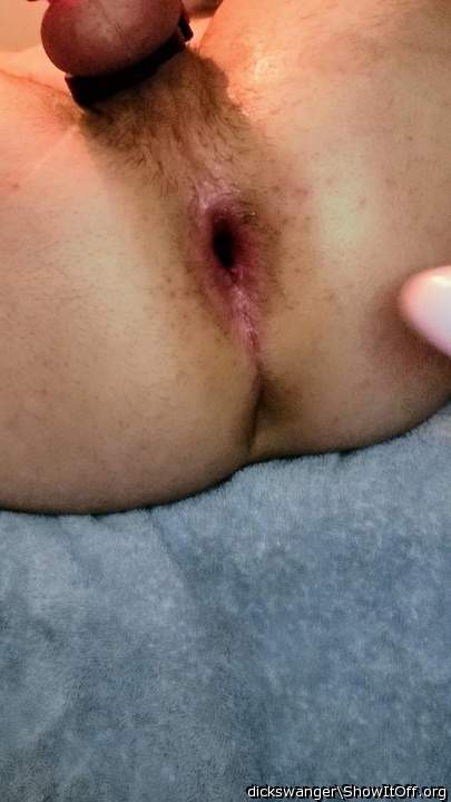 anal gape