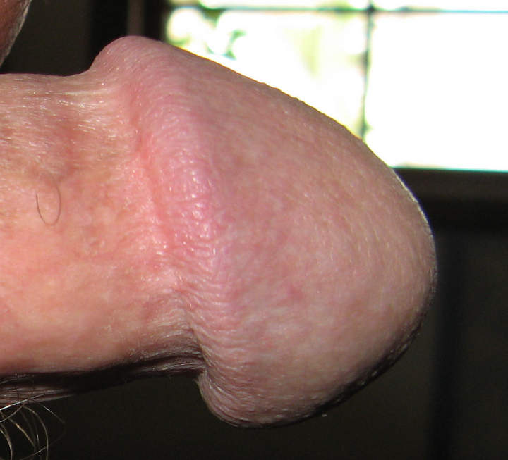 Photo of a pecker from turkeyneck