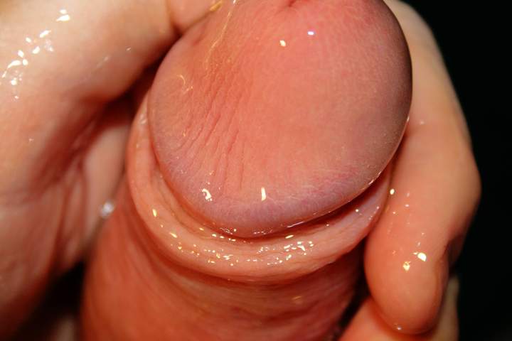 Photo of a penile from Vanillacum