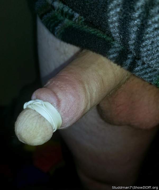 banding glans