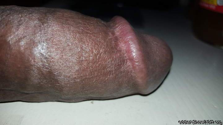 Photo of a prick from eddier