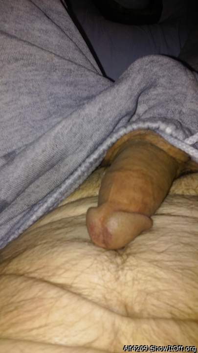 Photo of a short leg from Alf4269