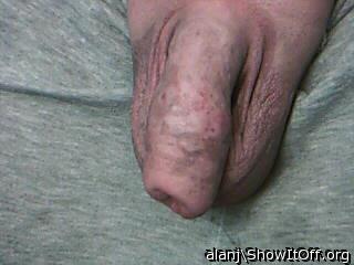 Photo of a prick from alanj