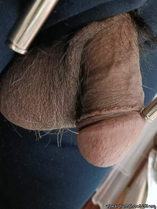 Oh wow. did you get circumcised?