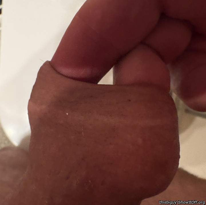 Skin stretch 2