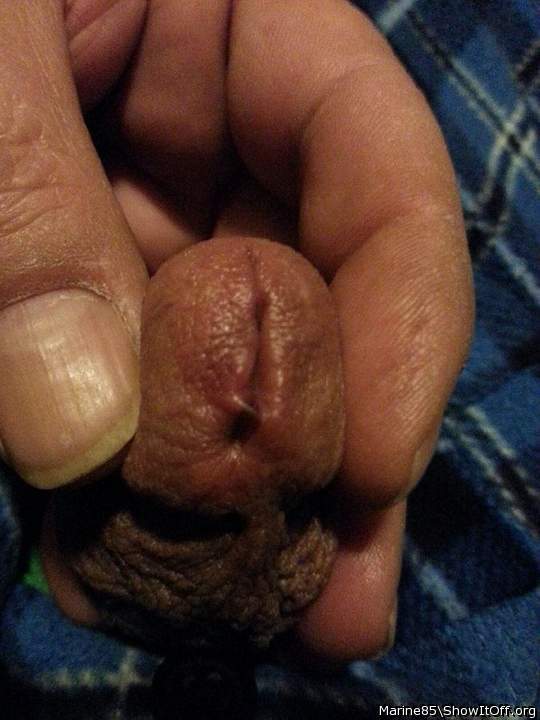 Second meatotomy cut