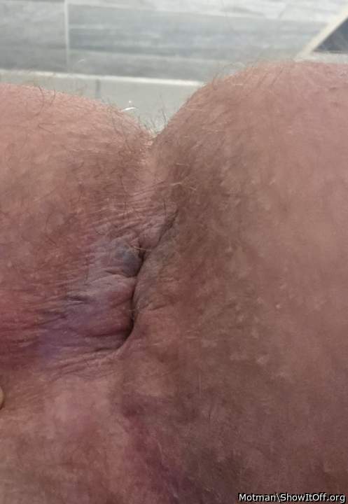 Photo of a love muscle from Motman