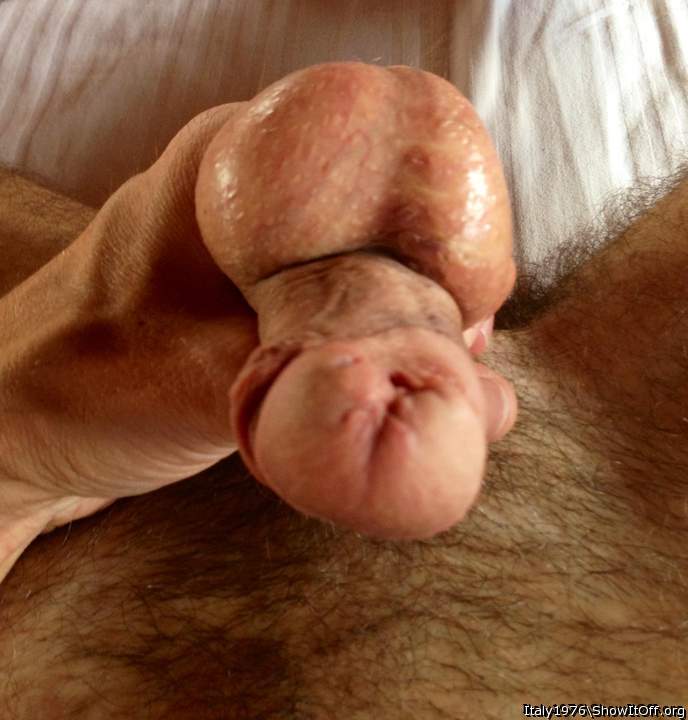 Photo of a penile from Italy1976