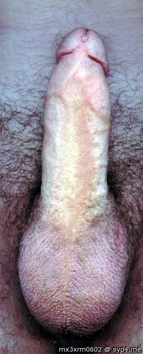 Photo of a middle leg from mx3xrm0602