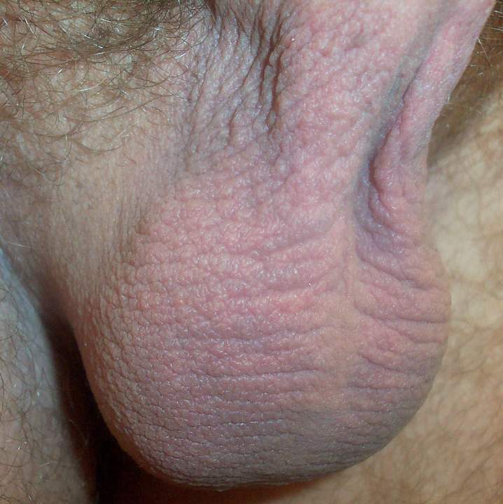 Testicles Photo from lilsoftee