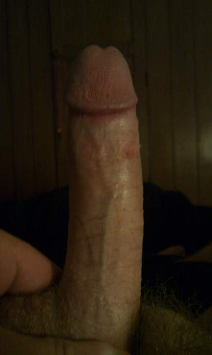 Photo of a private part from PK75