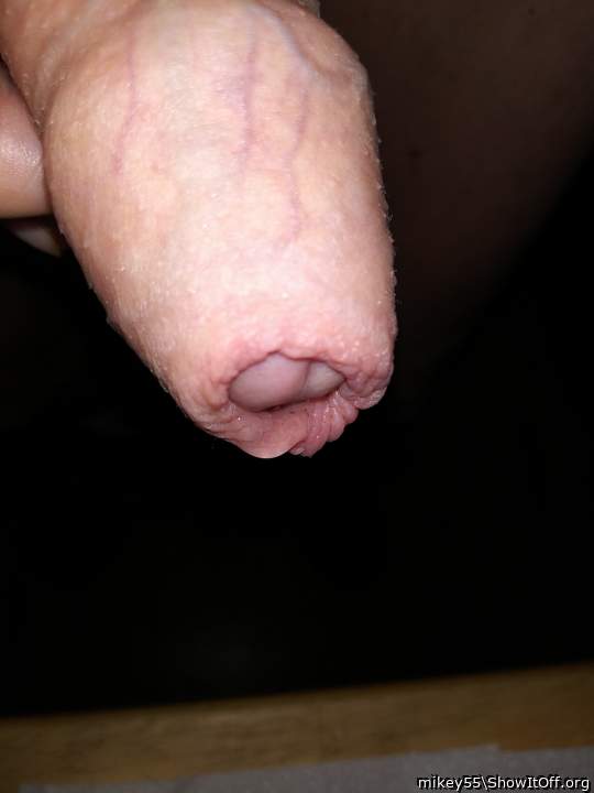 Foreskin