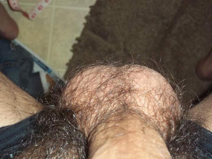 Testicles Photo from sdalex