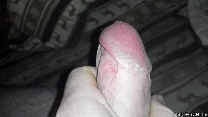 Photo of a bat from skinb