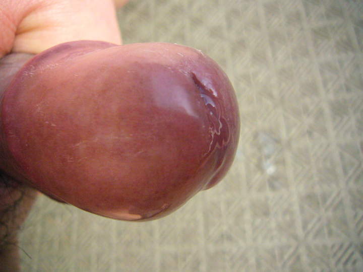 After wank
