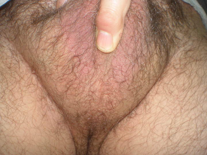 Testicles Photo from botanic