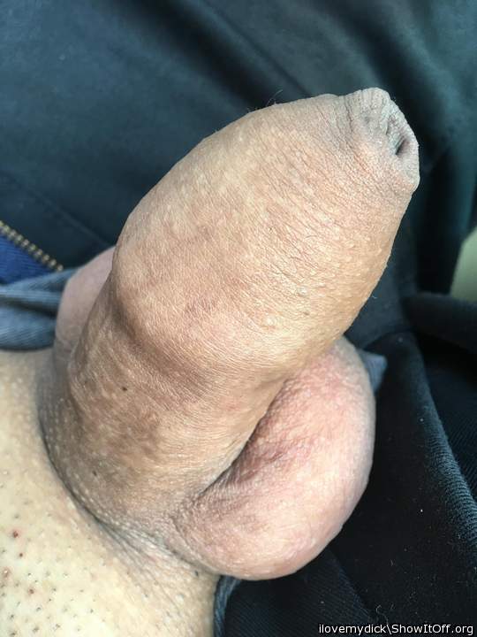 Love your foreskin  