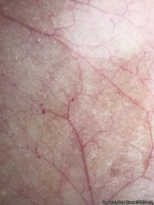 Wallpaper - My Scrotum Blood Vessel