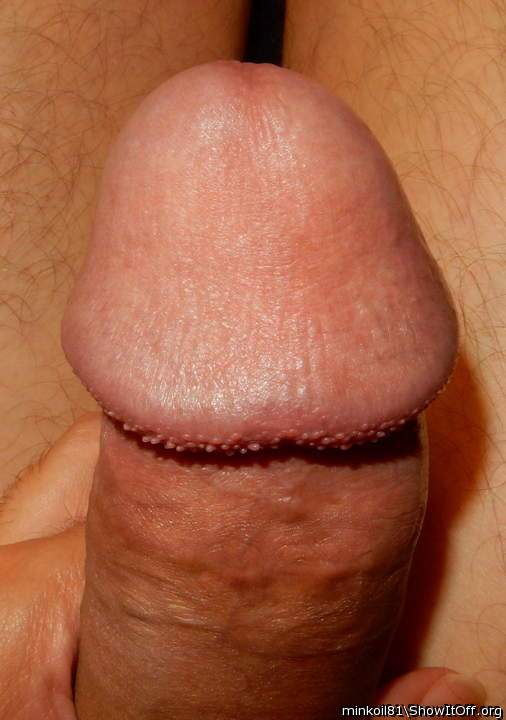Cockhead