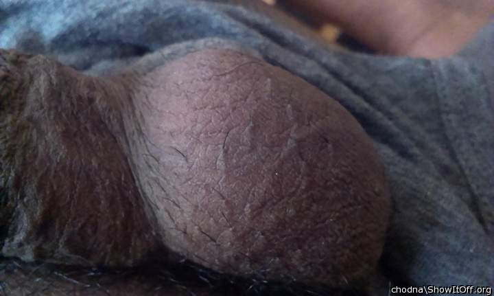 Testicles Photo from chodna