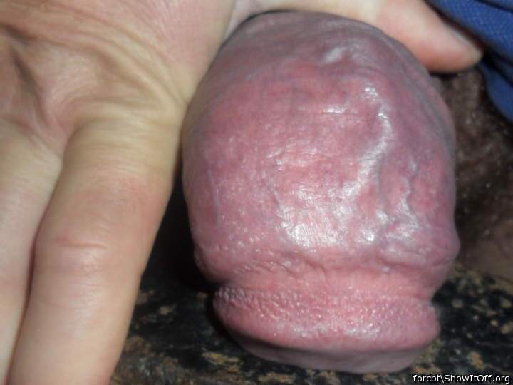 Photo of a prick from forcbt