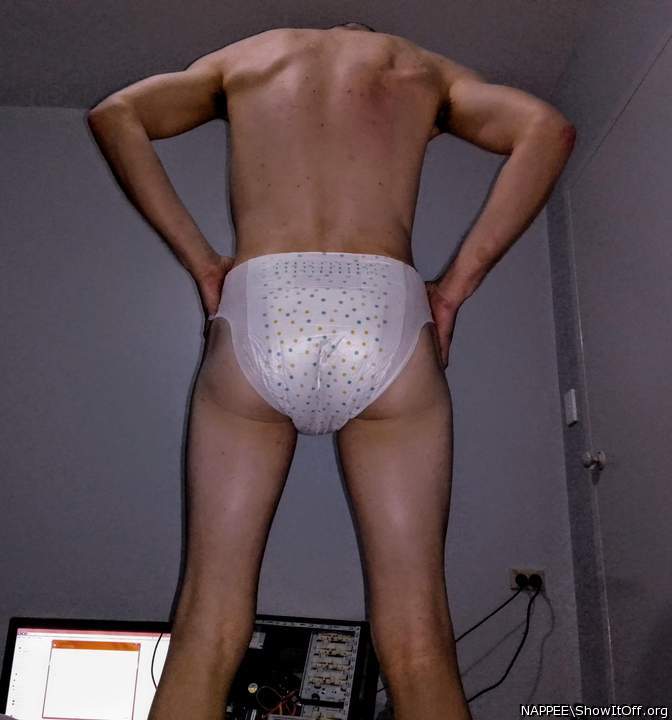 Photo of a short leg from NAPPEE