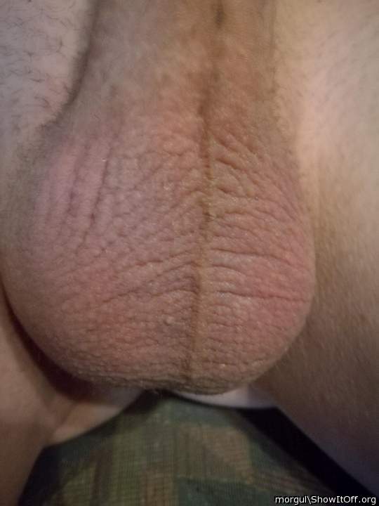 Testicles Photo from morgul