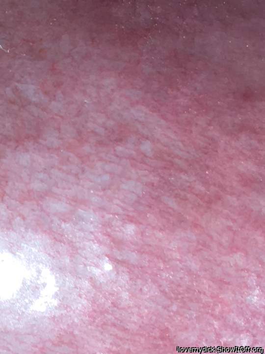 The texture of my dick head