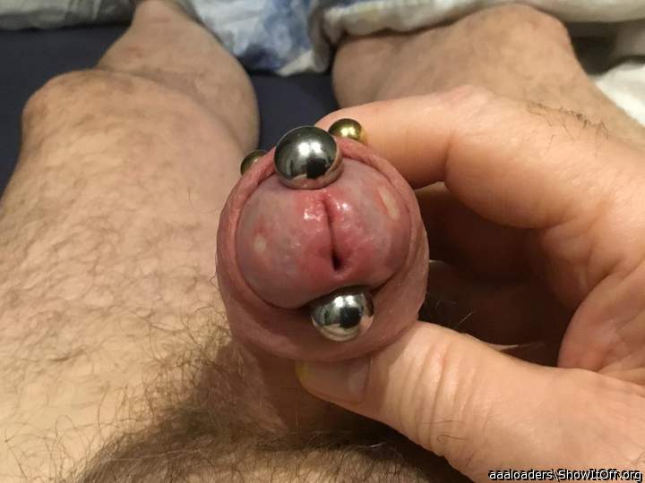Two burns on head, large and small barbell