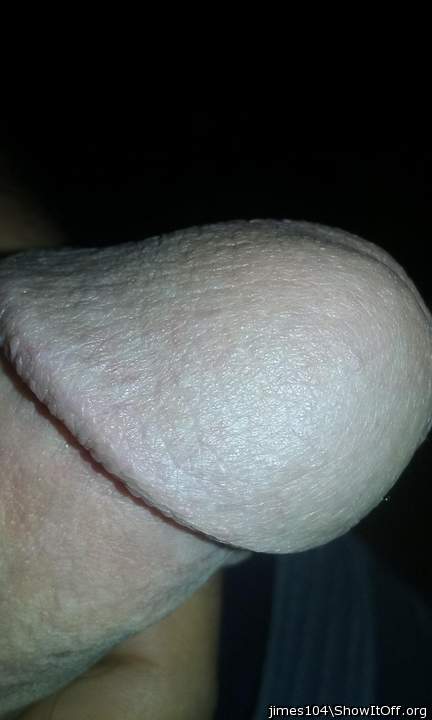Photo of a penis from jimes104