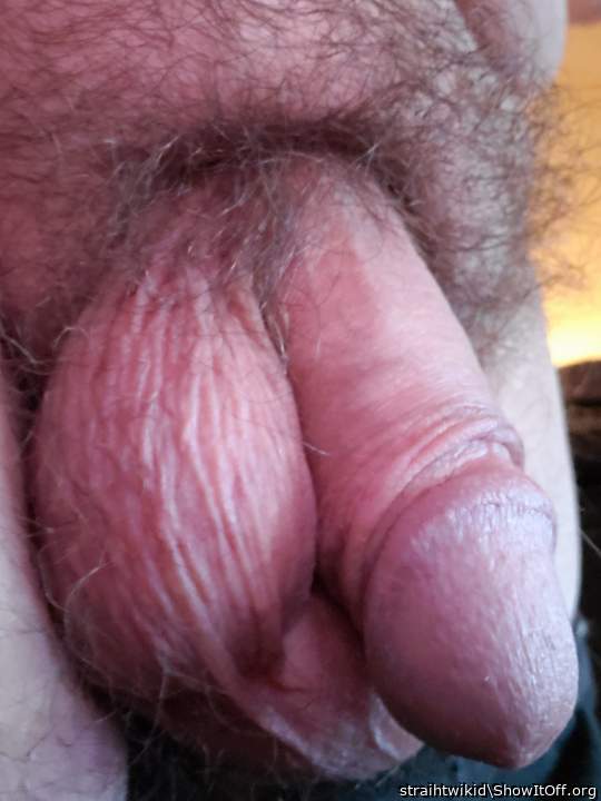 Photo of a private part from Wikid1