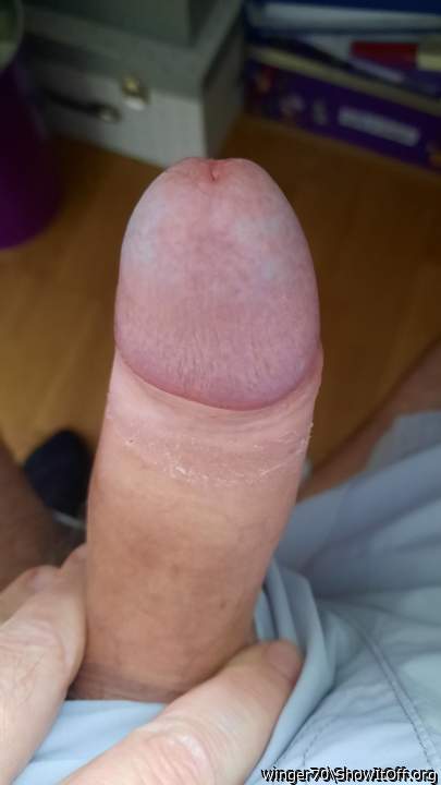 Photo of a middle leg from winger70