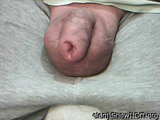 Photo of a middle leg from alanj