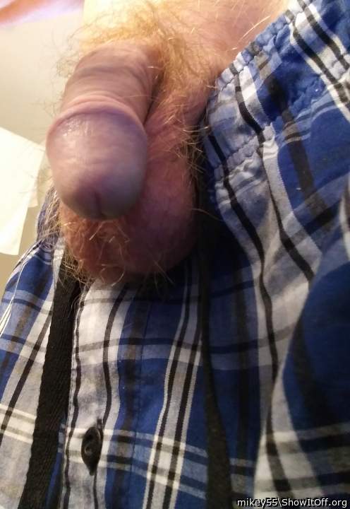 Foreskin retracted