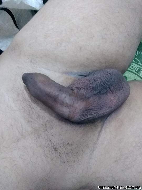 Photo of a prick from umeumef