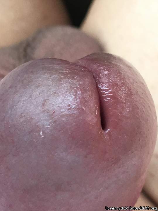 Not so hard pee slit