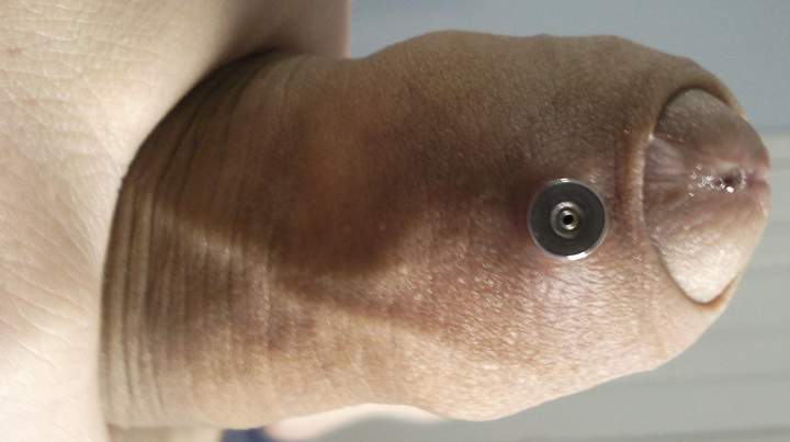 A hole through my foreskin 4