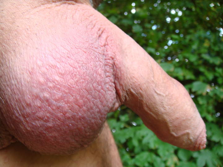 a full sack