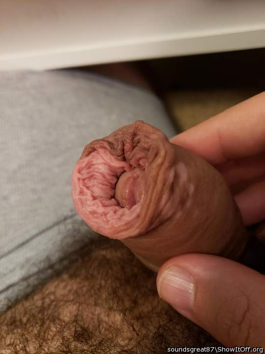 Really loose foreskin.