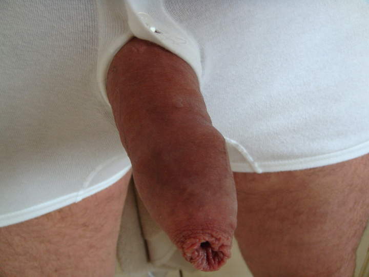 Photo of a wiener from sivad666