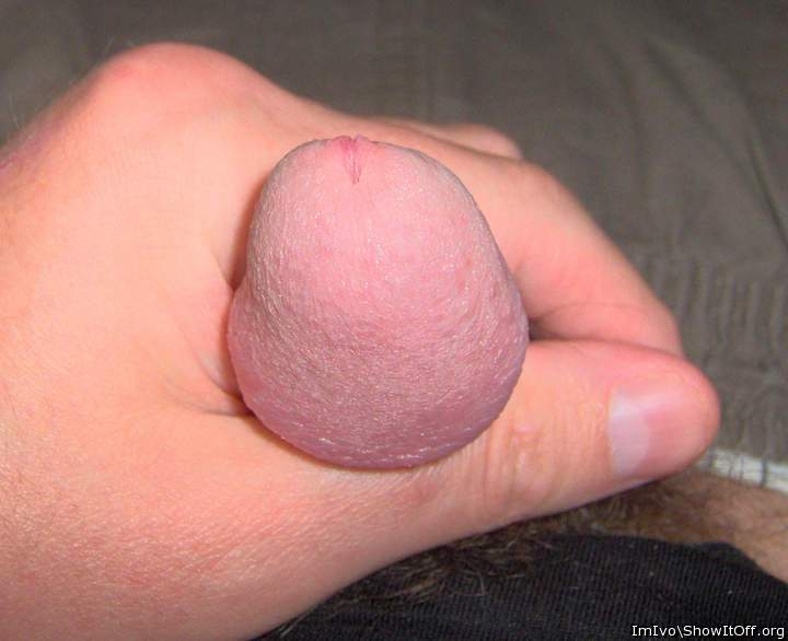 Nude glans (closeup)