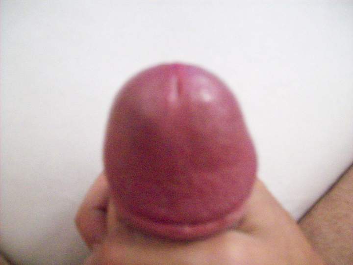 Swollen Head 2